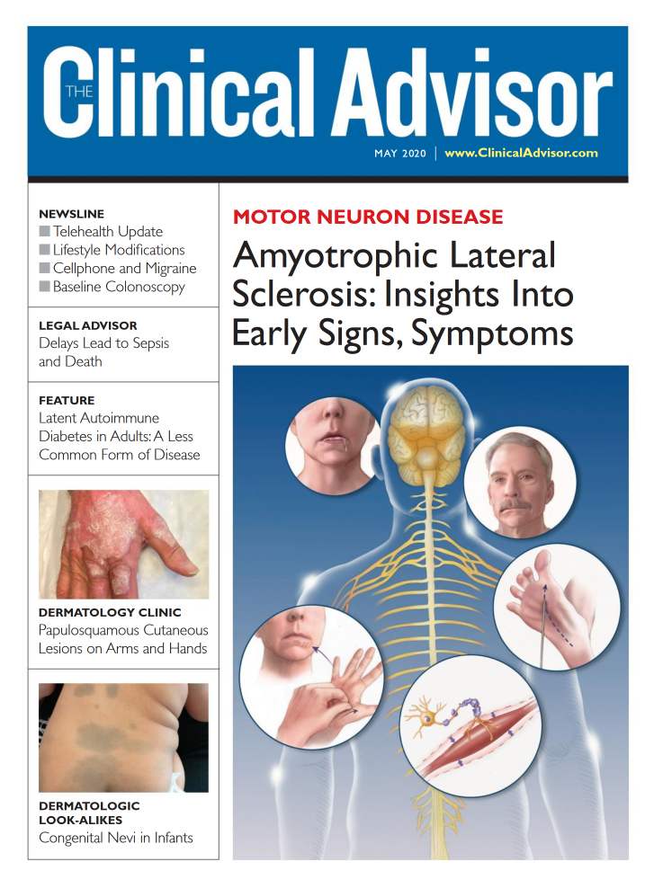 Clinical-Advisor May 01, 2020 Issue Cover